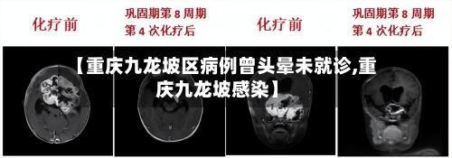 【重庆九龙坡区病例曾头晕未就诊,重庆九龙坡感染】-第2张图片